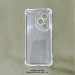 Honor 400 Pro | Clear Transparent Phone Case with Bumper Corners - Image 2